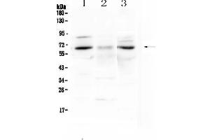 Image no. 2 for anti-Cholecystokinin B Receptor (CCKBR) antibody (ABIN5692993)