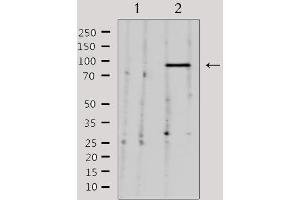 Image no. 1 for anti-Neural Precursor Cell Expressed, Developmentally Down-Regulated 9 (NEDD9) (Internal Region) antibody (ABIN6263585)