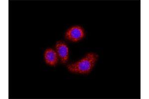 Image no. 1 for IKBKB & FOXO3 Protein Protein Interaction Antibody Pair (ABIN1339981)