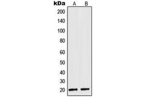 Image no. 2 for anti-NADH Dehydrogenase (Ubiquinone) 1 alpha Subcomplex, 8, 19kDa (NDUFA8) (Center) antibody (ABIN2706658)