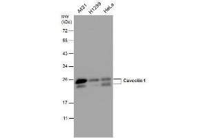 WB Image Caveolin 1 antibody detects Caveolin 1 protein by western blot analysis.