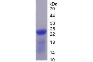 Image no. 3 for Thrombospondin 1 (THBS1) ELISA Kit (ABIN6574176)