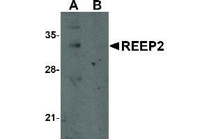 anti-Receptor Accessory Protein 2 (REEP2) (Internal Region) antibody