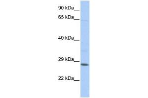 Image no. 1 for anti-TGFB-Induced Factor Homeobox 2-Like, X-Linked (TGIF2LX) (Middle Region) antibody (ABIN2775064)