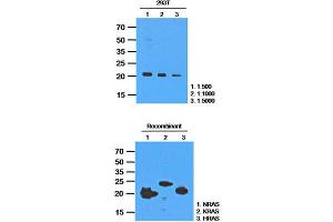 Image no. 2 for anti-GTPase NRas (NRAS) antibody (ABIN781533)