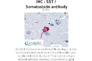 Image no. 1 for anti-Somatostatin (SST) antibody (ABIN1739665)
