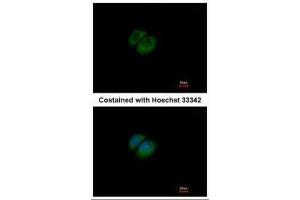 ICC/IF Image Immunofluorescence analysis of methanol-fixed A549, using HPRT, antibody at 1:500 dilution.