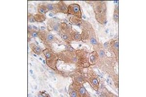 Image no. 2 for anti-Cytochrome P450, Family 3, Subfamily A, Polypeptide 5 (CYP3A5) (C-Term) antibody (ABIN360105)