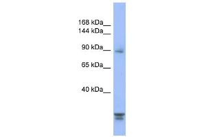 Image no. 1 for anti-Protein Phosphatase 2, Regulatory Subunit B'', alpha (PPP2R3A) (N-Term) antibody (ABIN2786686)