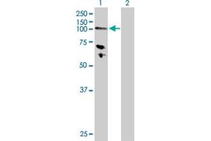 Image no. 1 for anti-Hexokinase 3 (White Cell) (HK3) (AA 1-923) antibody (ABIN516460)