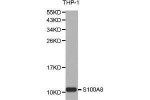Image no. 2 for anti-S100 Calcium Binding Protein A8 (S100A8) (pSer100) antibody (ABIN3022396)