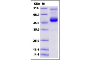 Image no. 1 for Regenerating Islet-Derived Family, Member 4 (REG4) (AA 1-157) protein (Fc Tag) (ABIN2009377)