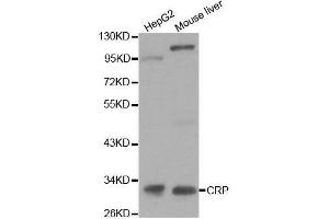 Image no. 3 for anti-C-Reactive Protein (CRP) antibody (ABIN3020716)