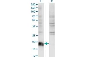Image no. 1 for anti-ADP-Ribosylation Factor 6 (ARF6) (AA 1-175) antibody (ABIN513465)