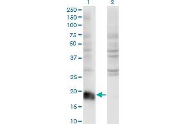 anti-ADP-Ribosylation Factor 6 (ARF6) (AA 1-175) antibody