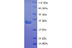 Image no. 1 for Arginine Vasopressin Receptor 1A (AVPR1A) (AA 7-52), (partial) protein (GST tag) (ABIN5712990)