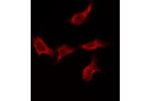 Image no. 1 for anti-Sodium Channel, Voltage-Gated, Type IV, alpha Subunit (SCN4A) antibody (ABIN6258330)