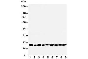 Image no. 1 for anti-Nucleoside diphosphate kinase B (NME2) (AA 137-152) antibody (ABIN3032112)
