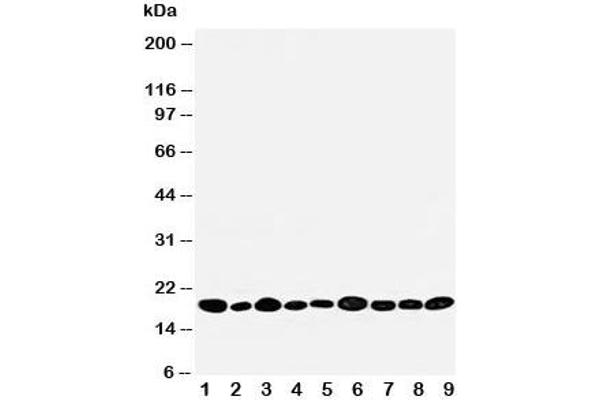 anti-Nucleoside diphosphate kinase B (NME2) (AA 137-152) antibody