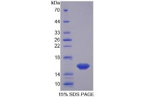 Image no. 1 for Osteoglycin (OGN) (AA 180-298) protein (His tag) (ABIN1171074)