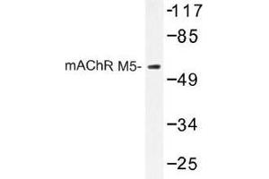 Image no. 1 for anti-Cholinergic Receptor, Muscarinic 5 (CHRM5) antibody (ABIN317740)