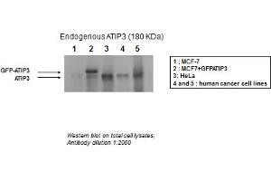 Image no. 4 for anti-Microtubule Associated Tumor Suppressor 1 (MTUS1) (Middle Region) antibody (ABIN2781855)