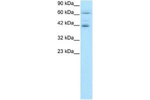 Image no. 1 for anti-Ets Variant 6 (ETV6) (C-Term) antibody (ABIN2792592)