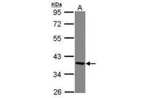 Image no. 2 for anti-Eukaryotic Translation Elongation Factor 1 delta (Guanine Nucleotide Exchange Protein) (EEF1D) (AA 310-647) antibody (ABIN1497948)