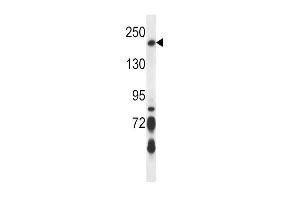 anti-BRCA1 Interacting Protein C-terminal Helicase 1 (BRIP1) (AA 132-163), (N-Term) antibody