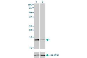 Image no. 4 for anti-Replication Protein A3, 14kDa (RPA3) (AA 12-121) antibody (ABIN562685)