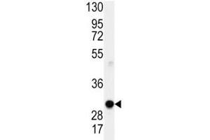 Image no. 6 for anti-Cyclin D1 (CCND1) (AA 68-97) antibody (ABIN3030588)