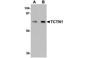 Image no. 1 for anti-Tectonic Family Member 1 (TCTN1) (N-Term) antibody (ABIN783637)