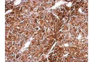 Image no. 1 for anti-PHD Finger Protein 16 (PHF16) (C-Term) antibody (ABIN2856485)