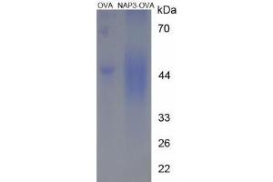 Image no. 3 for Chemokine (C-X-C Motif) Ligand 1 (Melanoma Growth Stimulating Activity, Alpha) (CXCL1) peptide (Ovalbumin) (ABIN5666309)