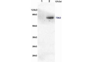 Image no. 3 for anti-CREB Regulated Transcription Coactivator 1 (CRTC1) (pSer151) antibody (ABIN746558)