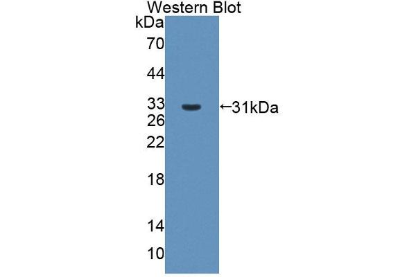 anti-ATP-Binding Cassette, Sub-Family B (MDR/TAP), Member 6 (ABCB6) (AA 590-842) antibody