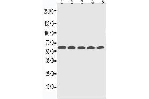 Image no. 3 for anti-Cytochrome P450, Family 2, Subfamily U, Polypeptide 1 (CYP2U1) (AA 457-473), (C-Term) antibody (ABIN3044054)