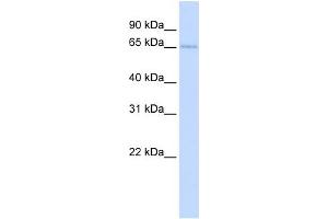 WB Suggested Anti-TKTL2 Antibody Titration:  0.