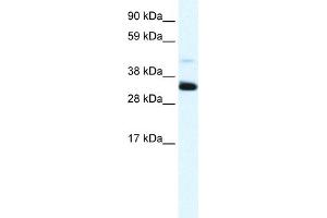 Image no. 2 for anti-Annexin A3 (ANXA3) (N-Term) antibody (ABIN2774839)