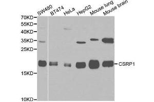 anti-Cysteine and Glycine-Rich Protein 1 (CSRP1) antibody