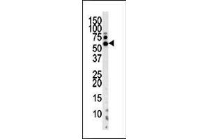 Image no. 3 for anti-PTEN Induced Putative Kinase 1 (PINK1) (AA 118-147), (N-Term) antibody (ABIN390369)