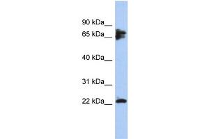Image no. 1 for anti-Protein Phosphatase 3, Regulatory Subunit B, alpha (PPP3R1) (N-Term) antibody (ABIN2786524)
