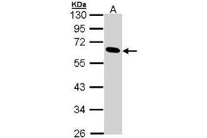 Image no. 4 for anti-Pancreatic Lipase (PNLIP) (Center) antibody (ABIN2856717)