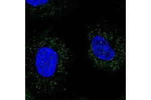 Image no. 2 for anti-WD Repeat Domain 48 (WDR48) antibody (ABIN5590891)
