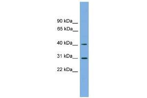 Image no. 1 for anti-Hydroxy-delta-5-Steroid Dehydrogenase, 3 beta- and Steroid delta-Isomerase 7 (HSD3B7) (Middle Region) antibody (ABIN2783973)