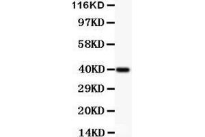 Image no. 3 for anti-conserved Helix-Loop-Helix Ubiquitous Kinase (CHUK) (AA 411-745) antibody (ABIN3043812)