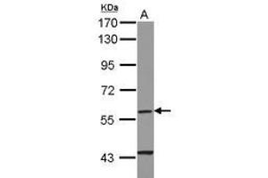 Image no. 1 for anti-Cytochrome P450, Family 4, Subfamily F, Polypeptide 11 (CYP4F11) (AA 1-235) antibody (ABIN1497739)