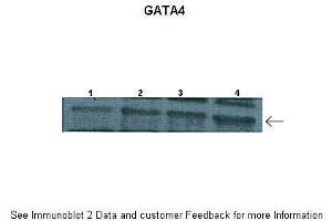 Image no. 2 for anti-GATA Binding Protein 4 (GATA4) (N-Term) antibody (ABIN2780394)
