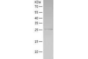 AKR1C2 Protein (AA 1-256) (His tag)