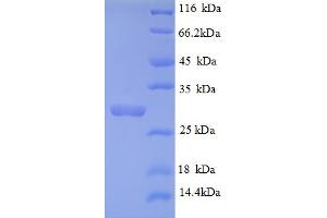 Image no. 1 for Collagen, Type IV, alpha 3 (COL4A3) (AA 1446-1667), (partial) protein (His tag) (ABIN5709311)